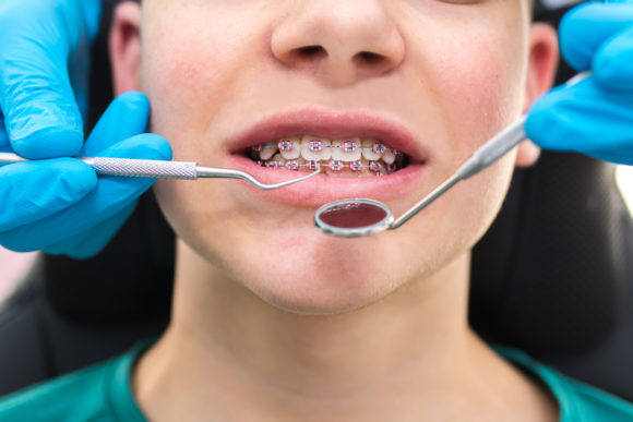 PRE-DENTISTRY WITH RICHER EDUCATION. SUMMER CAMPS